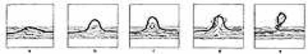 Darstellung der Entwicklung eines Pillings in fünf Stufen. Darstellung der Entwicklung eines Pillings in fünf Stufen.